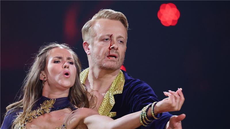 Ross Antony ist eine Runde weiter - obwohl ihm nach einem kleinen Unfall Blut über das Gesicht lief.