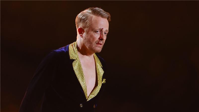 Ross Antony tanzt in der RTL-Tanzshow „Let’s Dance“ im Coloneum und hat sich eine blutende Wunde zugezogen.