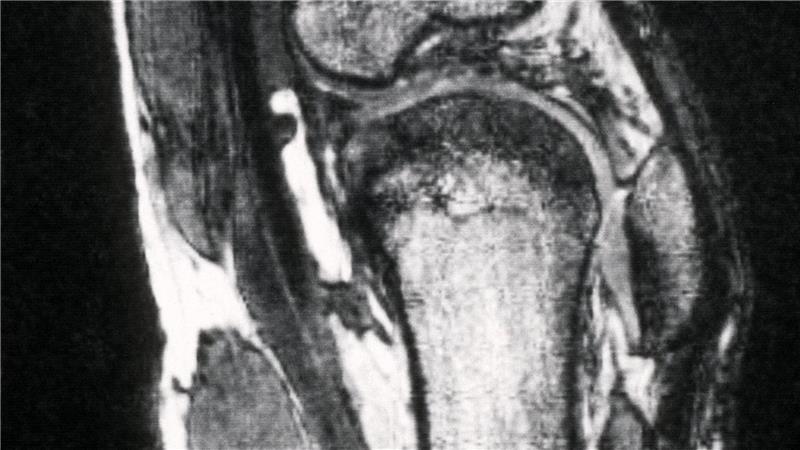 Schmerzen im Knie treiben viele Versicherte zum Orthopäden - viele kommen dort mit fragwürdigen Therapien in Kontakt. (Archivbild)