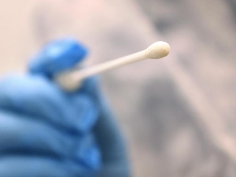 Schnelltests sollen die Öffnungsschritte begleiten. Foto: Karl-Josef Hildenbrand/dpa