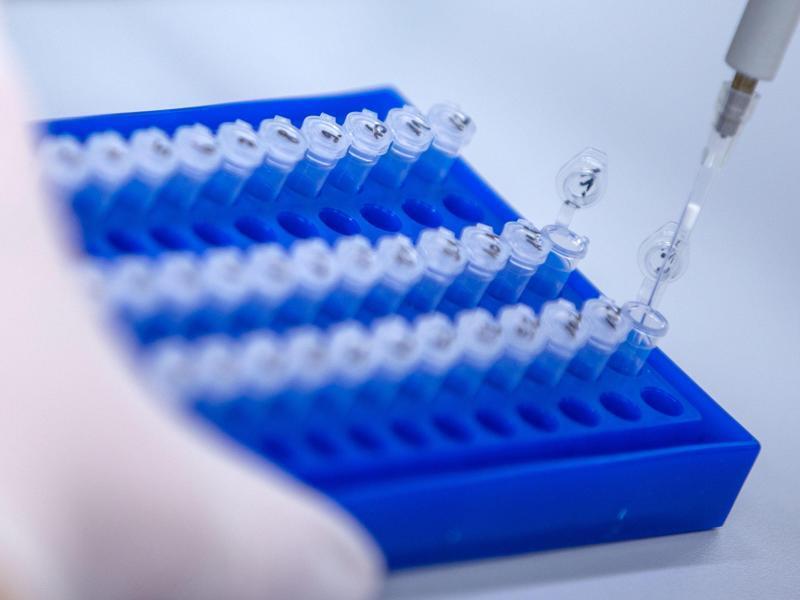 Sequenzierproben für Untersuchungen von Corona-Proben in einem Labor für Corona-Varianten. Foto: Jens Büttner/dpa