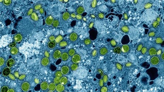 So sehen die Mpox-Viruspartikel unter dem Mikroskop aus. (Archivbild)