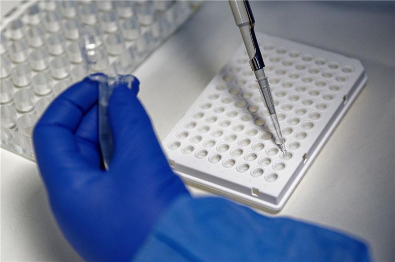 Testkapazitäten und Gesundheitsämter sind am Limit. Foto: dpa