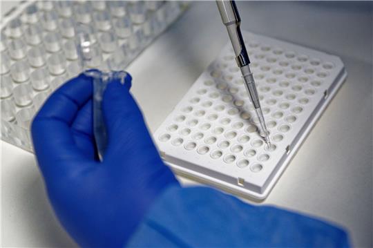 Testkapazitäten und Gesundheitsämter sind am Limit. Foto: dpa