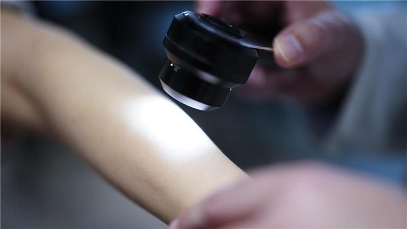 Unter den 35- bis 39-Jährigen in Hamburg gingen deutlich mehr Frauen zur Hautkrebsvorsorge als Männer. (Symbolbild)