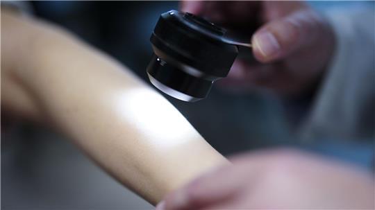 Unter den 35- bis 39-Jährigen in Hamburg gingen deutlich mehr Frauen zur Hautkrebsvorsorge als Männer. (Symbolbild)