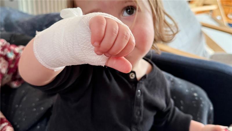Brandwunden im Advent: So geht Erste Hilfe Verbrannt am heißen Pfannenrand: Ein Wundverband schützt die verletzte Stelle.