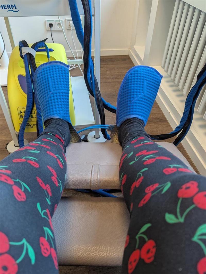 Während der Chemotherapie trug Katja Grunewald Kältehandschuhe und -socken.