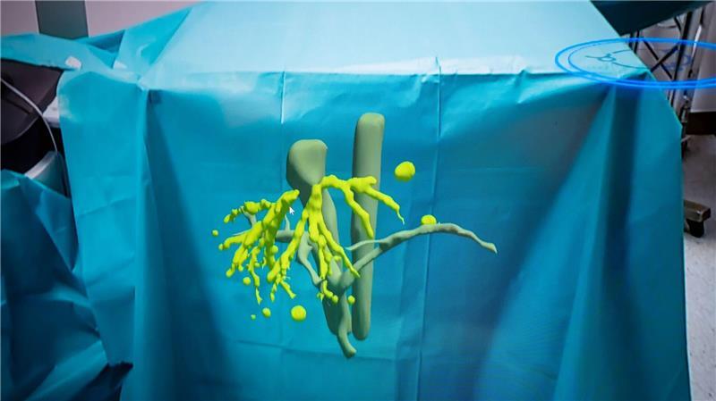 Wer durch eine spezielle Brille blickt, sieht ein virtuelles Modell der Leber im OP-Saal vor sich.