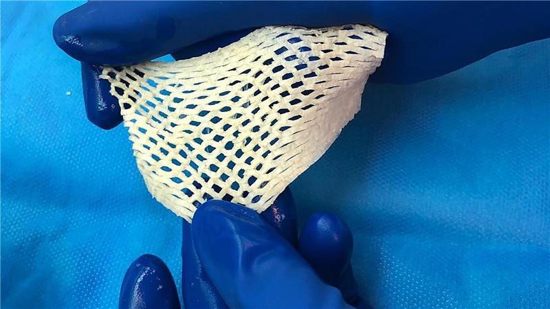 Wichtige Alternative für Hautttansplantationen: Fischhaut.