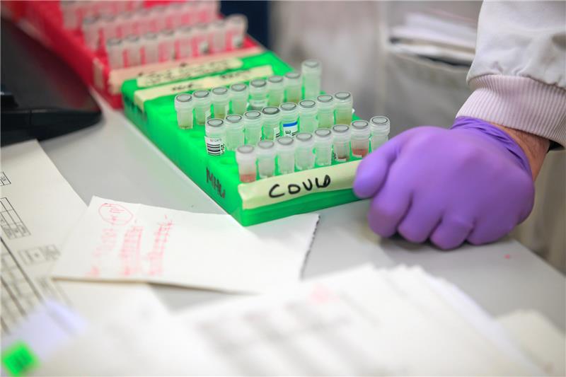 <p>Proben des Coronavirus werden untersucht.  Foto: dpa</p>